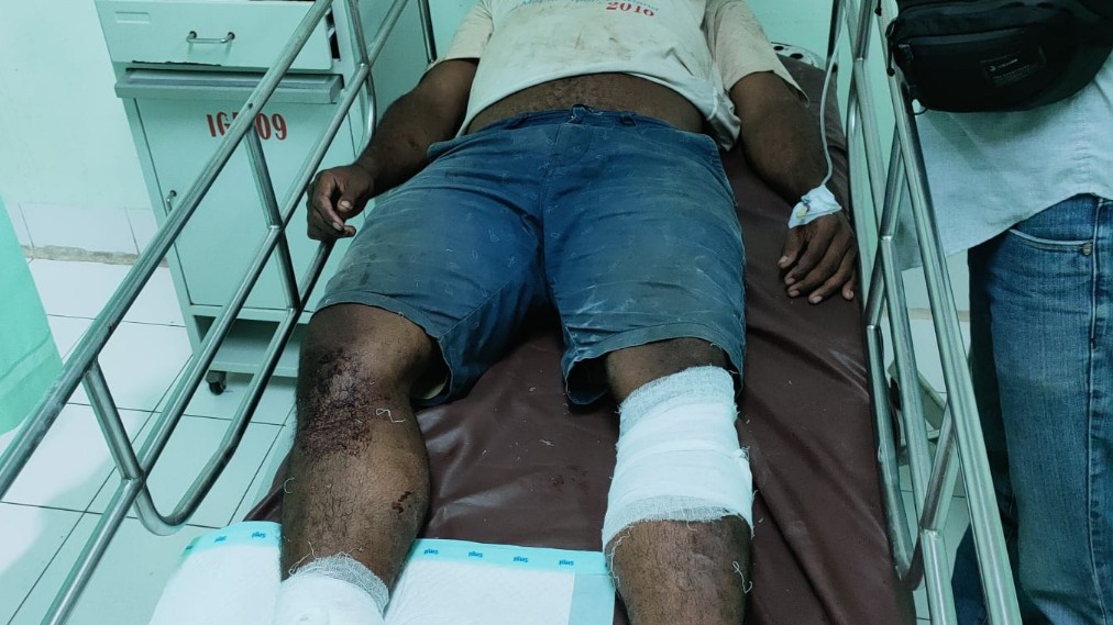 FA mendapat perawatan medis pasca dilumpuhkan aparat keamanan di Kwamki Narama, Sabtu (30/10/2021). Foto: Istimewa